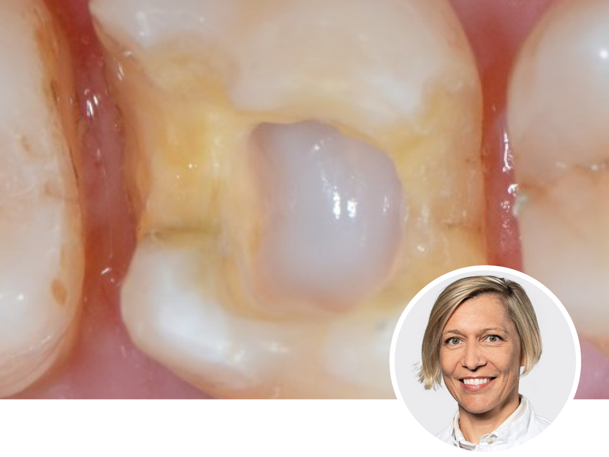 Die Trickkiste der Zahnerhaltung | 13. - 14.11.2026 | München