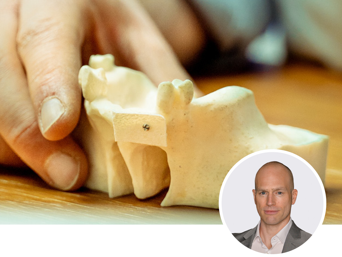 Osseodensification - Sofortimplantation mit Knochenverdichtung | 02.12.2026