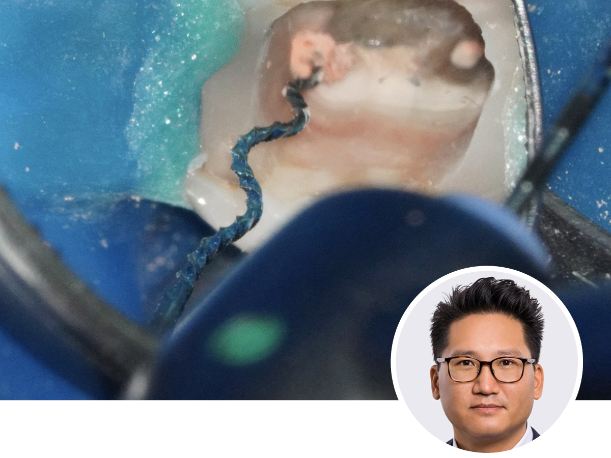 Mission Wurzelfüllung - Präzision bis ins Detail | 14.11.2026 | Hamburg