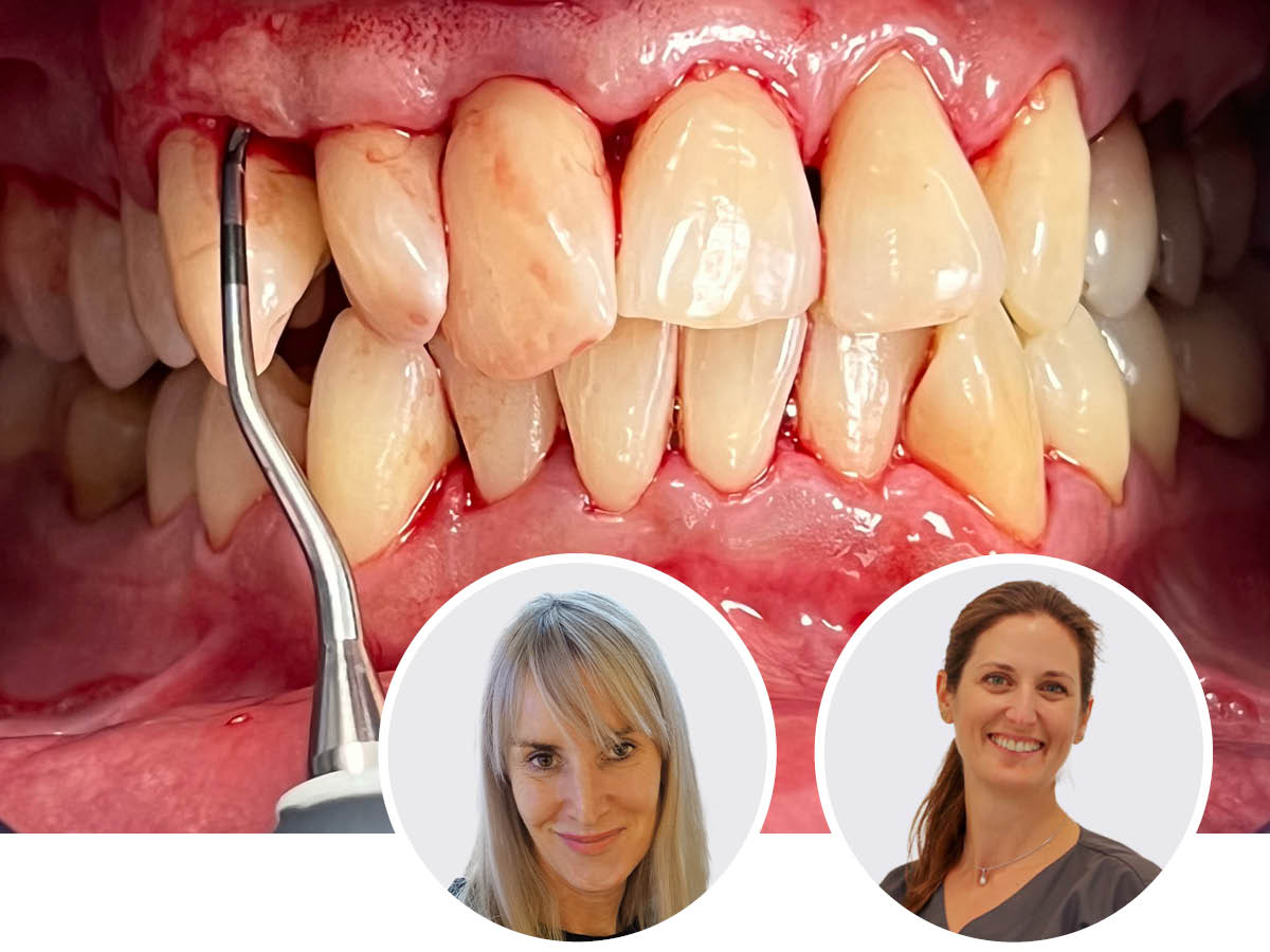 Parodontitis und ihre Wechselwirkungen | 25.04.2026 | München