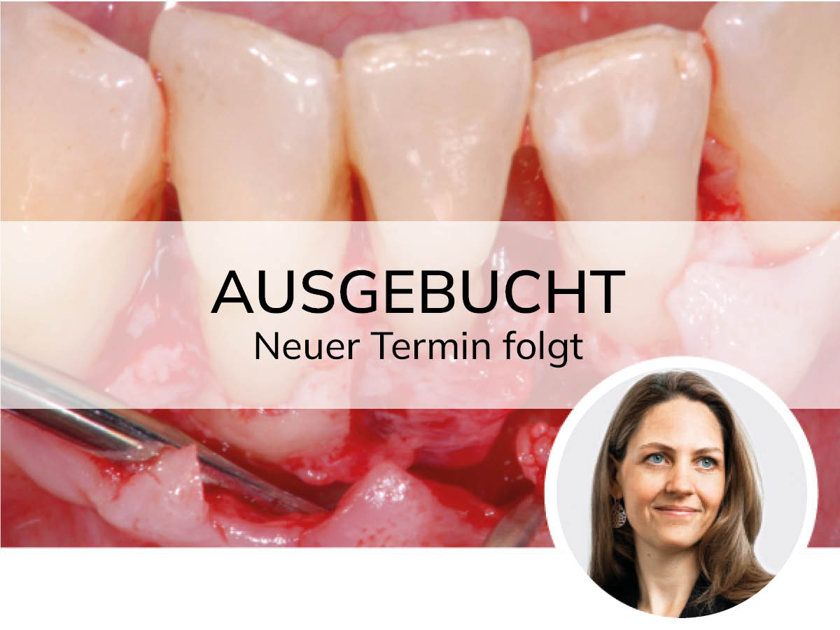 Regenerative Parodontitis-Therapie - Möglichkeiten und Limitationen | 13.09.2025 | Köln