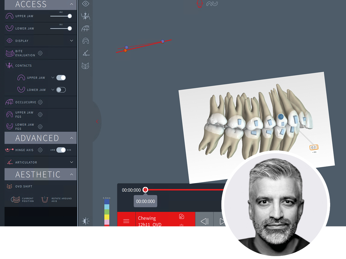 Modjaw - Anwendung Jaw Tracking Systeme in der funktionsorientierten Kieferorthopädie | 09.05.2026 | Köln