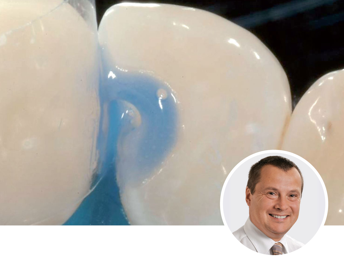 Grundlagen der Adhäsivtechnik | 05.-06.12.2025 | Köln