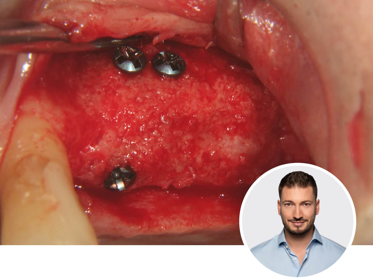 The Perfect Bone | 12. - 13.06.2026 | München