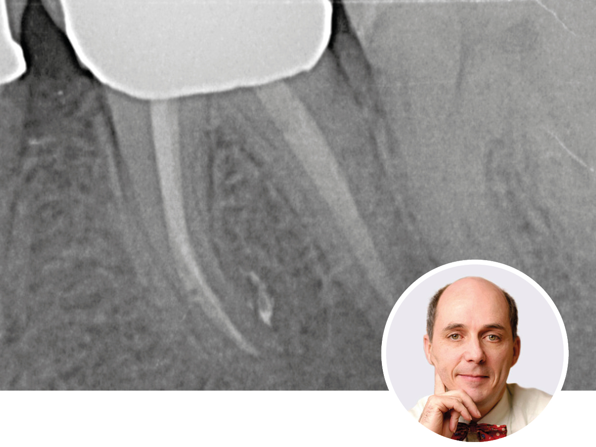 Moderne Endodontologie für den Allgemeinpraktiker | 04. - 05.12.2026 | Köln