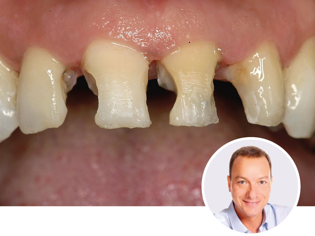 Adhäsive Restaurationen - rundherum an einem Wochenende |  10. - 11.07.2026 | München