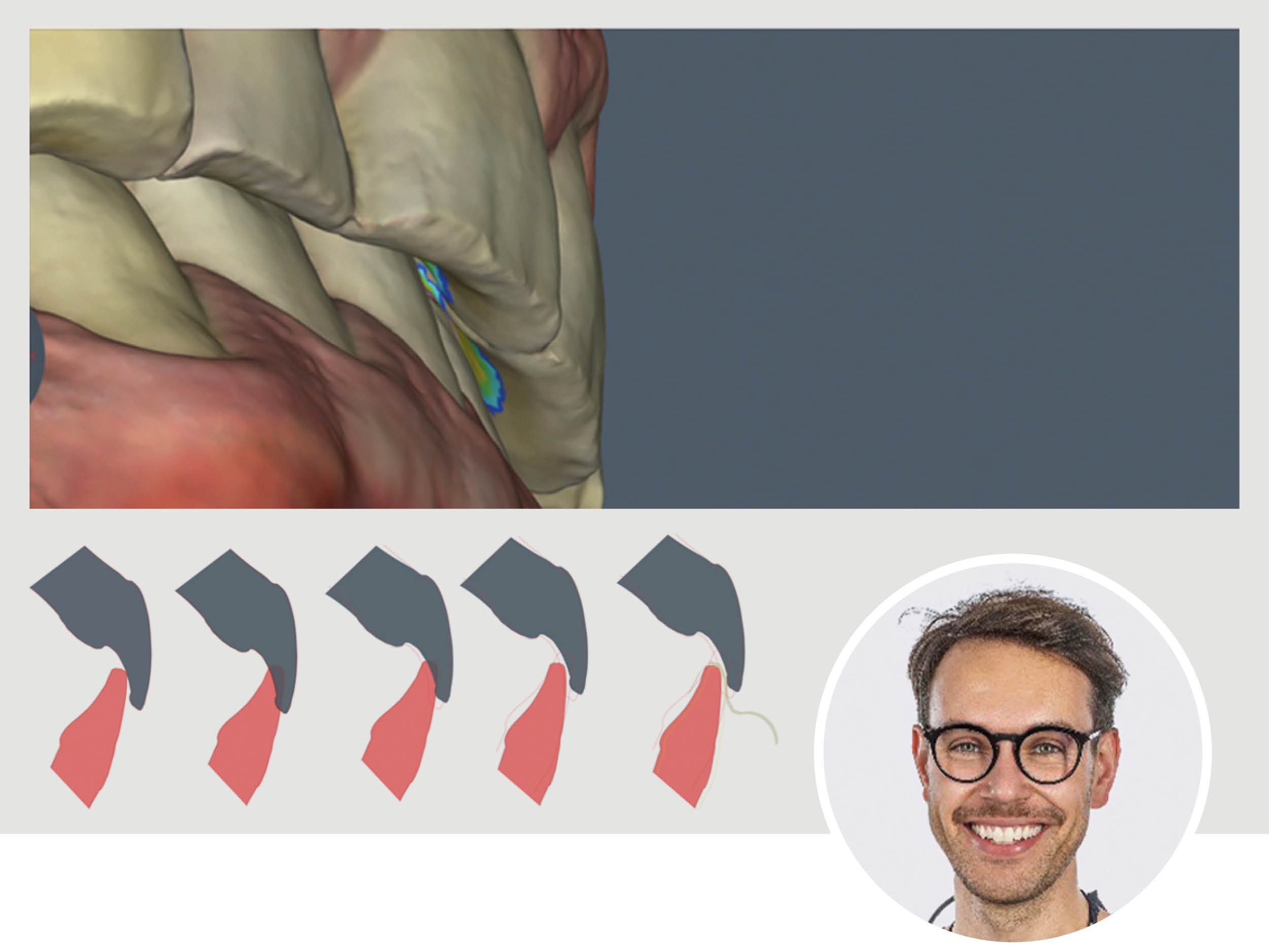 KFO: Von der Zahnbewegung zur integgrativen Therapie | 19. - 20.06.2026 | München