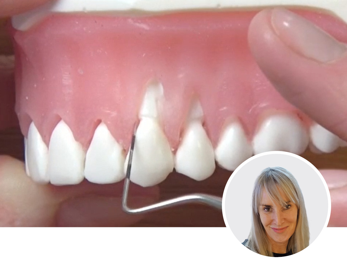 Hormonelle Einflüsse auf Gingiva und Parodontium | 24.09.2025