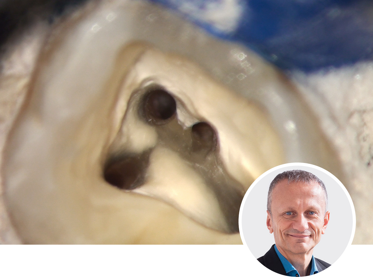 Das Mikroskop in der Endodontie - ein Update | 13.06.2026 | Nürnberg