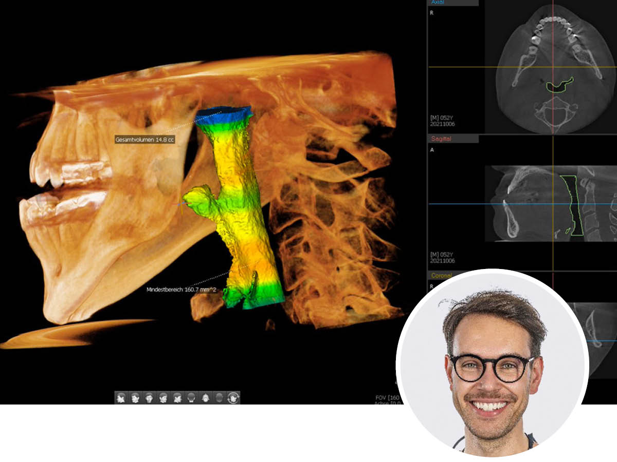Airway: Zahnmedizin ist mehr als Zähne gerade stellen | 25. - 26.09.2026 | Köln