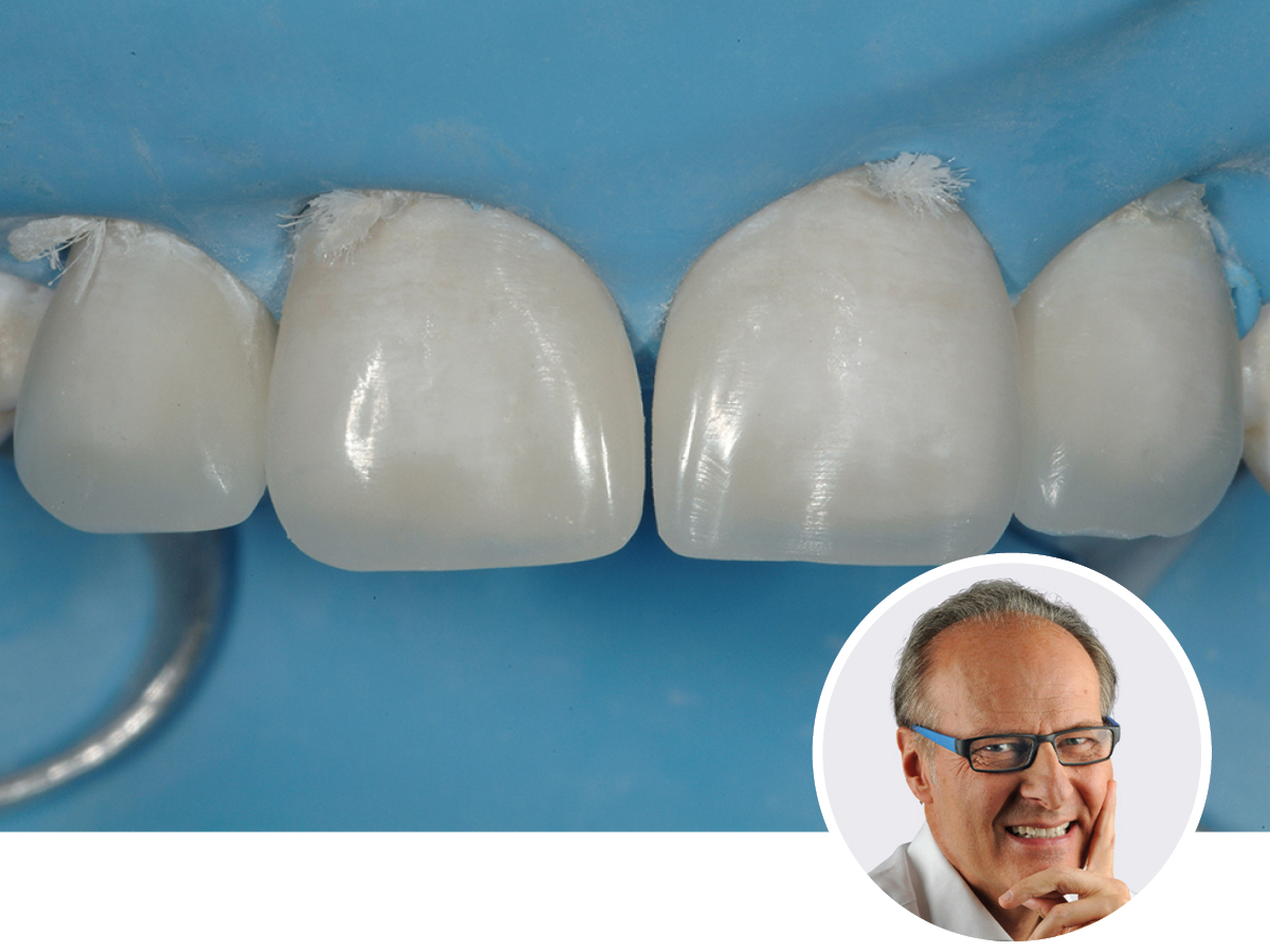 Direkte ästhetische Frontzahnrestaurationen | Theorietag | 07.11.2025 | Köln